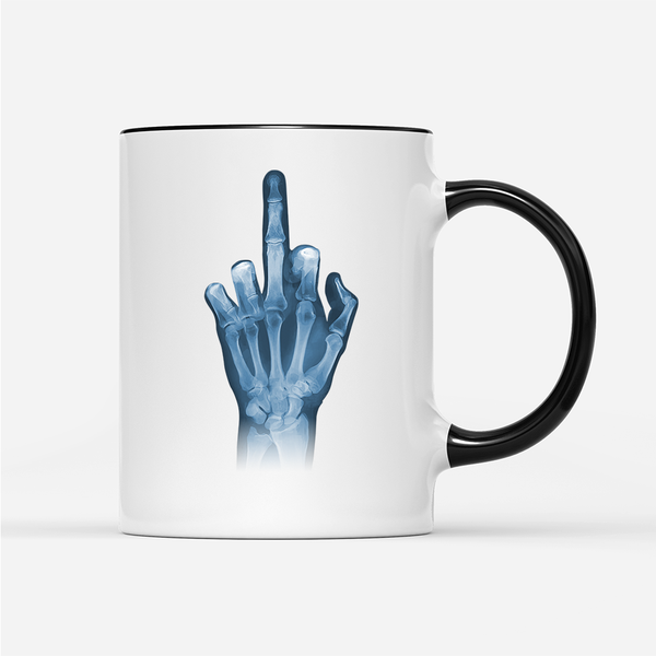 Tasse Röntgen Mittelfinger